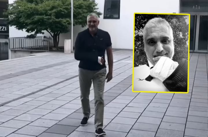 ČEDA JOVANOVIĆ OPET U GIPSU!