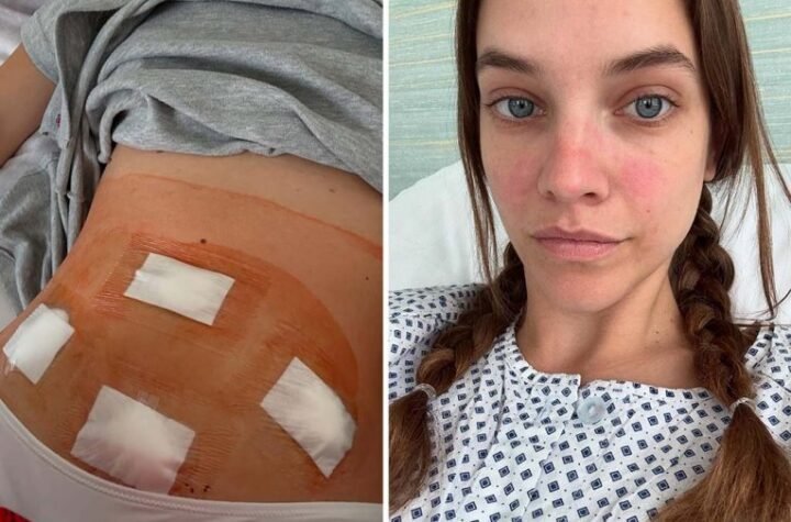KRVARENJA SU BILA PREOBILNA, VALJALA SE PO PODU OD BOLA! Barbara Pavlin HITNO OPERISANA!