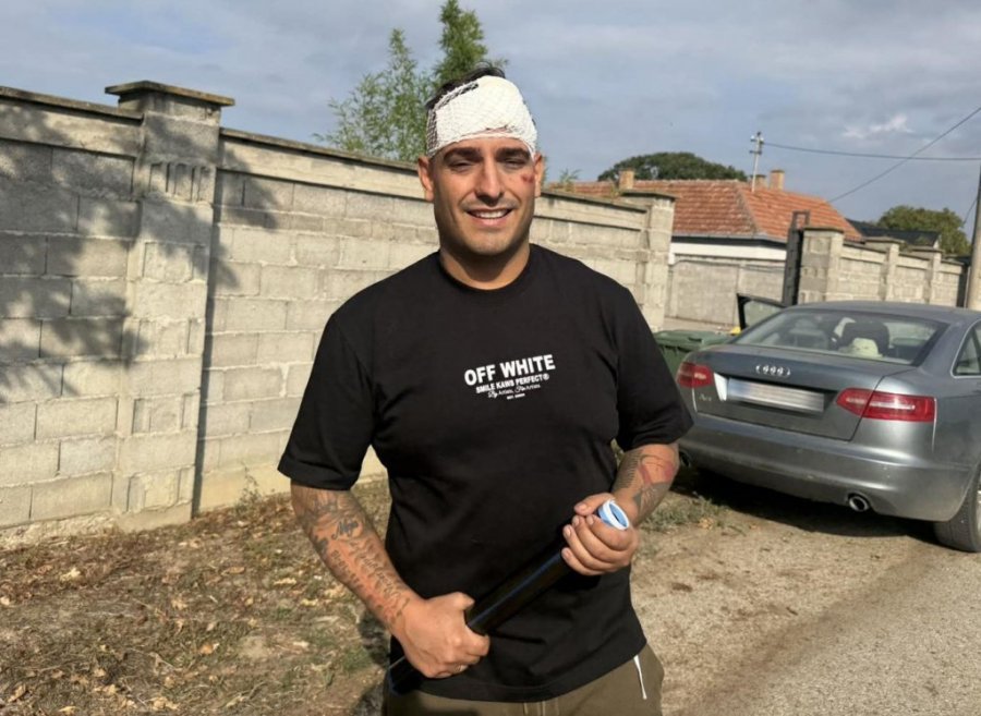 ZVANIČNO SAOPŠTENJE POLICIJE O UDESU DARKA LAZIĆA: Pevač UGROZIO OPŠTU BEZBEDNOST, MUP pokrenuo hitne mere!
