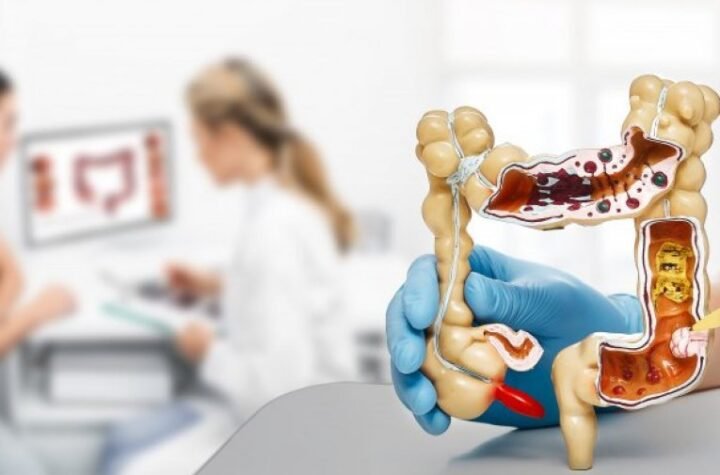 OVAJ RAK KOSI MUŠKARCE U SRBIJI! Evo kako sprečiti najgore!