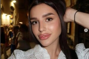 ŠOK IZDANJE ĆERKE ZDRAVKA ČOLIĆA! Lara ZAPALILA MREŽE, ruka joj sva krvava! (FOTO)