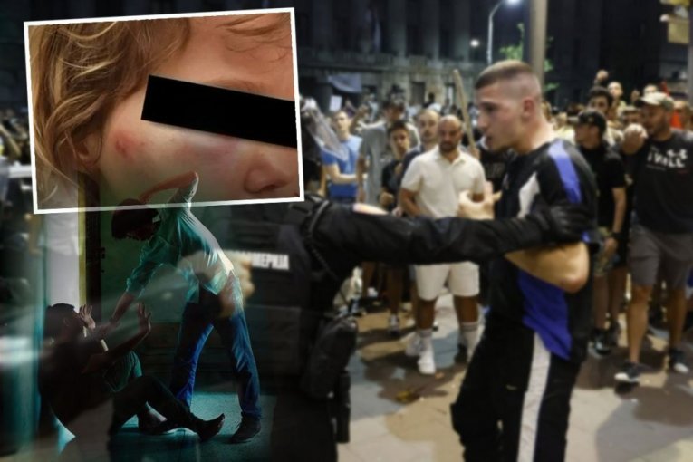 GODINA BLOKADERSKOG IŽIVLJAVANJA PRETOČENA U NASILJE NAD DETETOM! Ovo je znak da su NASILNICI PRETERALI