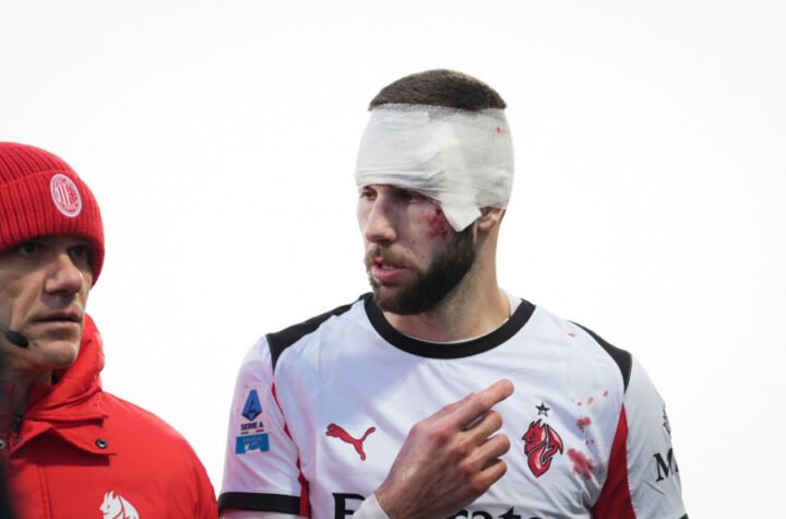 DEVET KOPČI NA GLAVI I LITAR KRVI NA DRESU: Novi detalji o stanju Strahinje Pavlovića! (FOTO)