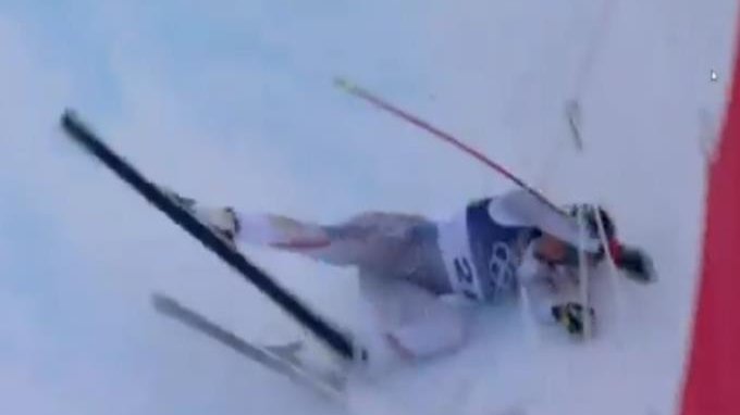 LINDZI VON HITNO OPERISANA: Amerikanka doživela težak prelom nakon HOROR pada