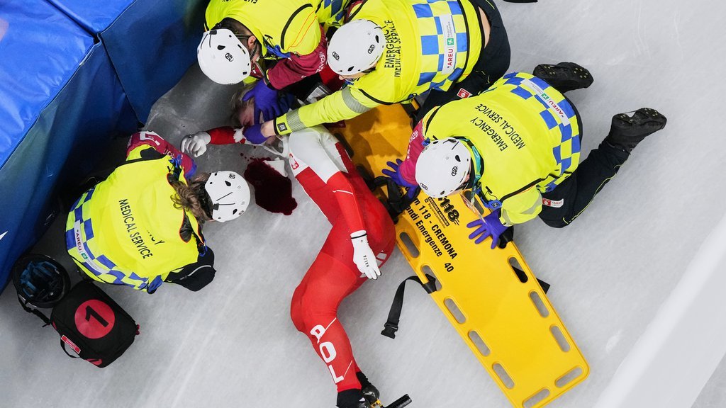 OVO JE KLIZAČICA KOJA JE PROŠLA KROZ PAKAO NA ZOI! Doživela HOROR povredu i završila u lokvi krvi: Osvojila brojne medalje, pa umalo OSTALA BEZ OKA