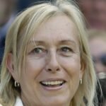 'BILO JE VREME...' Transrodnim ženama udarili zabranu, oglasila se Jedna od najvećih svih vremena