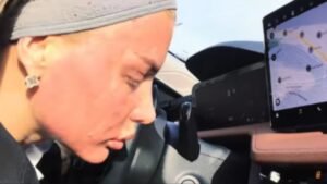 MILICI KEMEZ CELO LICE CRVENO I U OŽILJCIMA! Bivša zadrugarka šokirala, hladi glavu klimom u automobilu: Zabrinula mnoge