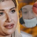 NATAŠA UPOZORAVA SRPKINJE - NE ŽELITE DA PROĐETE KAO ONA! Samo je OPERACIJOM mogla da sredi DEFORMISANA USTA
