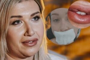 NATAŠA UPOZORAVA SRPKINJE - NE ŽELITE DA PROĐETE KAO ONA! Samo je OPERACIJOM mogla da sredi DEFORMISANA USTA