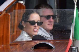 ŠTA SE DOGODILO ŠVAJNIJU? Anin bivši pokazao ruku punu modrica (FOTO)