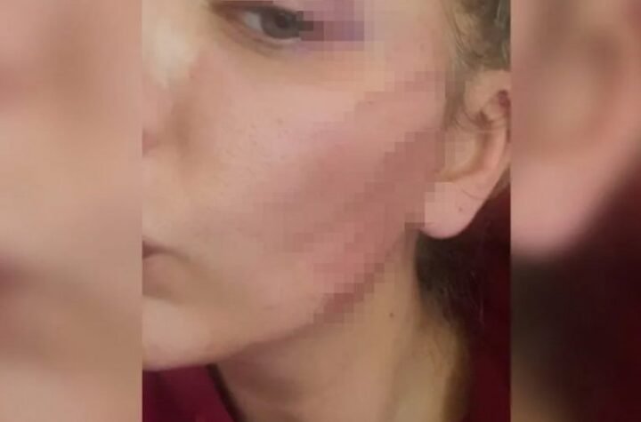 "NIJE IMAO PREBIJENE PARE, ŽIVELI SMO KAO PODSTRANARI!" Potresno svedočenje pretučene Ave Karabatić, KROZ SUZE SE SETILA SVEGA!