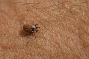 Ovu kardinalnu grešku svi rade kada vade krpelje! Ne padaju samo sa drveća, stručnjaci izdali upozorenje