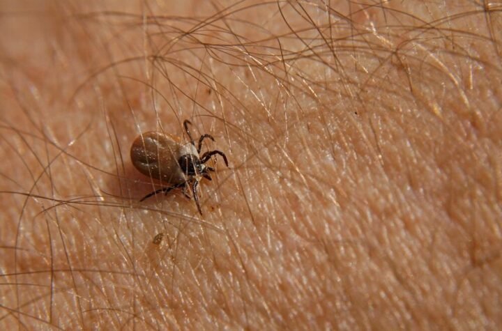 Ovu kardinalnu grešku svi rade kada vade krpelje! Ne padaju samo sa drveća, stručnjaci izdali upozorenje