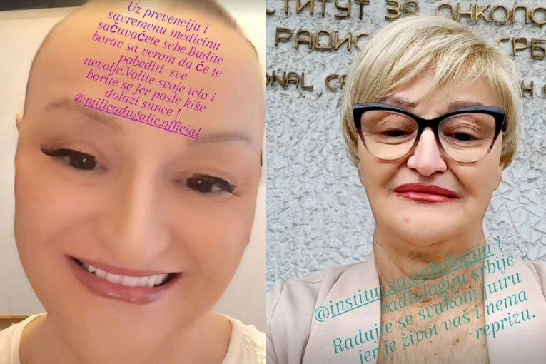 "KOSA ĆE PORASTI, NADAM SE DA ĆU OVO DA POBEDIM": Teška borba Milice Dugalić s rakom dojke: Ne mogu da odem na onaj svet, a da nisam...