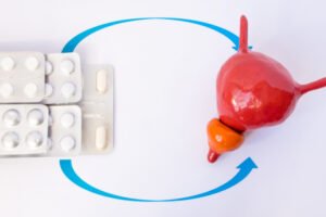 Kod uvećane prostate lekovi su privremeno rešenje problema sa mokrenjem
