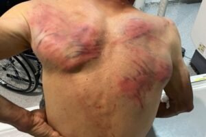 PRVE REČI BRUTALNO PREBIJENOG SRBINA U ZUBINOM POTOKU: "Vezali su me za bukvu, stavili krpu u usta i tukli me crevom - ZATRAŠIVALI SU MI SINA I ŽENU!"