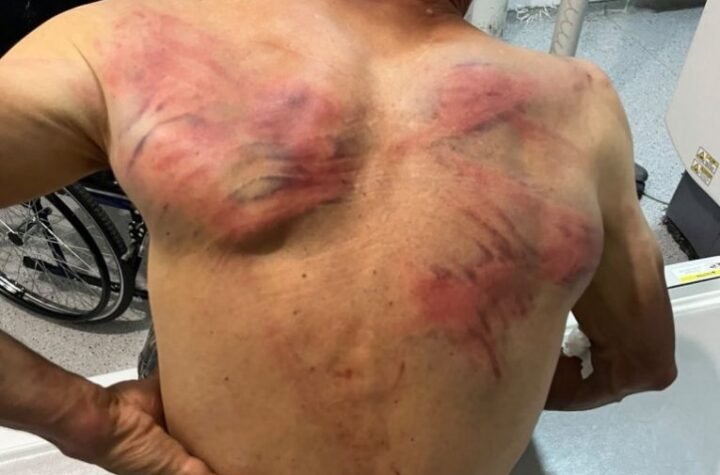 PRVE REČI BRUTALNO PREBIJENOG SRBINA U ZUBINOM POTOKU: "Vezali su me za bukvu, stavili krpu u usta i tukli me crevom - ZATRAŠIVALI SU MI SINA I ŽENU!"