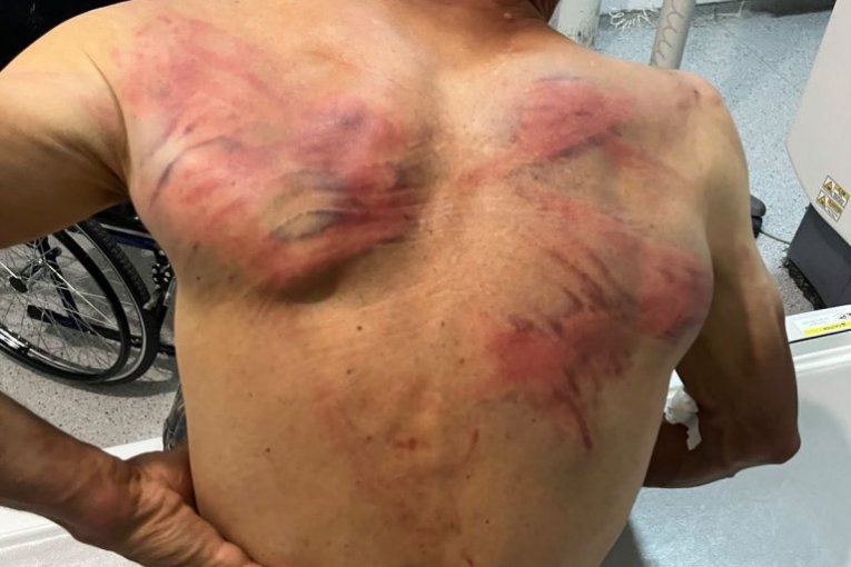 PRVE REČI BRUTALNO PREBIJENOG SRBINA U ZUBINOM POTOKU: "Vezali su me za bukvu, stavili krpu u usta i tukli me crevom - ZATRAŠIVALI SU MI SINA I ŽENU!"