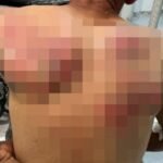 "SEDAM LICA TOKOM PRIVOĐENJA PREBIJENO!" Simić o brutalnosti Kurtijeve policije