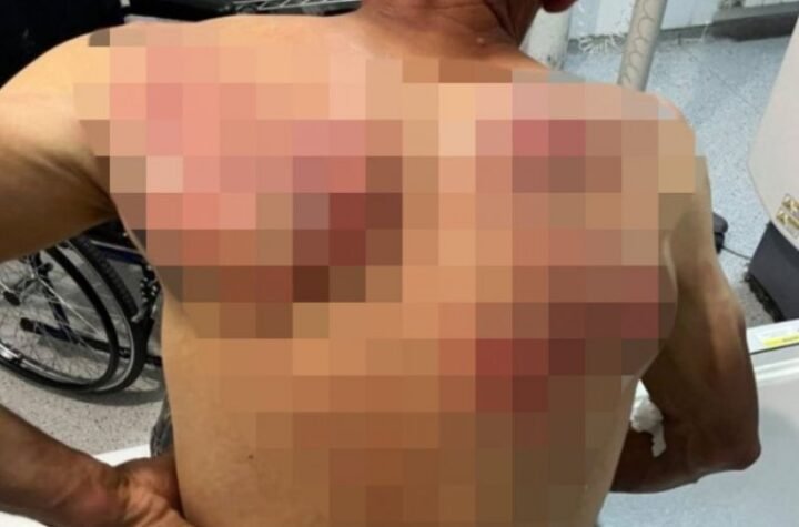 "SEDAM LICA TOKOM PRIVOĐENJA PREBIJENO!" Simić o brutalnosti Kurtijeve policije