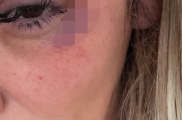 NOVI DETALJI U SLUČAJU PRETUČENE PEVAČICE: Evo šta se desilo!