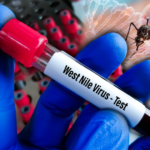 OPASNI VIRUS NE JENJAVA U SRBIJI! "Batut" objavio najnoviji presek, većina obolelih u teškom stanju